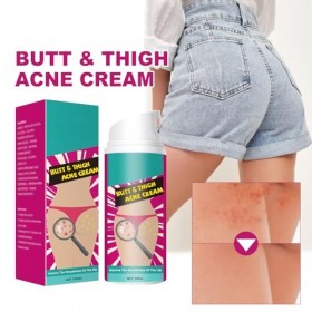 100ml Crème Dissolvant de Boutons pour les Fesses,Butt Treatment Cream,Traitement de Nettoyage des Boutons des Fesses