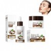 Hppsctink 40ml Sérum à lhuile de coco et 50g Crème à la noix de coco, hydratant et nourrissant, Raffermissement de la peau, 