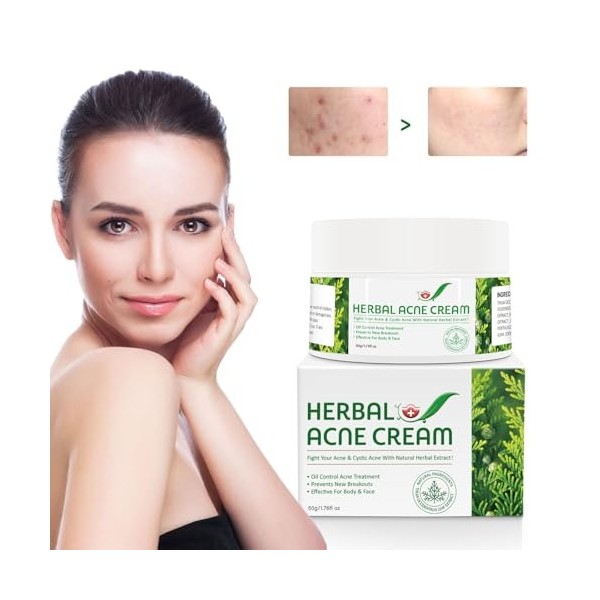 Crème naturelle à base de plantes contre lacné 50g, Crème Hydratante Visage, Améliore léclat lisse et lhumidité, Facial Ne