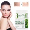Crème naturelle à base de plantes contre lacné 50g, Crème Hydratante Visage, Améliore léclat lisse et lhumidité, Facial Ne