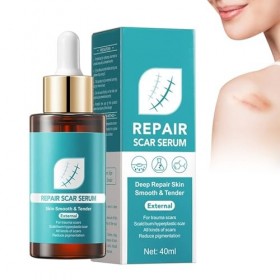 Sérum de réparation de cicatrices, essence de réparation, essence naturelle de cicatrice, soin de la peau doux, traitement de