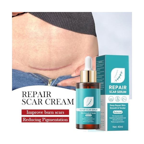 Sérum de réparation de cicatrices, essence de réparation, essence naturelle de cicatrice, soin de la peau doux, traitement de