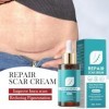 Sérum de réparation de cicatrices, essence de réparation, essence naturelle de cicatrice, soin de la peau doux, traitement de