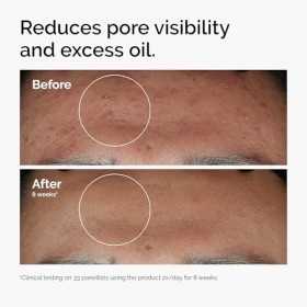 The Ordinary Niacinamide 10% + Zinc 1%, Sérum illuminant et lissant, pour les peaux sujettes aux imperfections, 30 ml Lot de ...