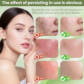 40ml Sérum Visage,Soin Sérum,Soin Visage pour Atténuer les Imperfections,Soin Quotidien Convient à la Plupart des Types de Pe