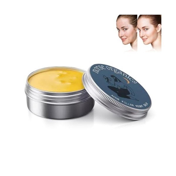 Fengyang® Norse Organics Baume Anti-acné, Redness Relief Balm, Tueur Dacné Et De Rougeurs, Crème Nourrissante Pour La Peau, 