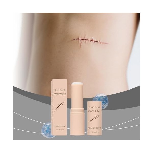 Bâton Silicone Cicatrices, Stick Hydratant Cicatrice De Peau, Bâton De Cicatrice, Silicone Scar Stick, Réparation De Marques 
