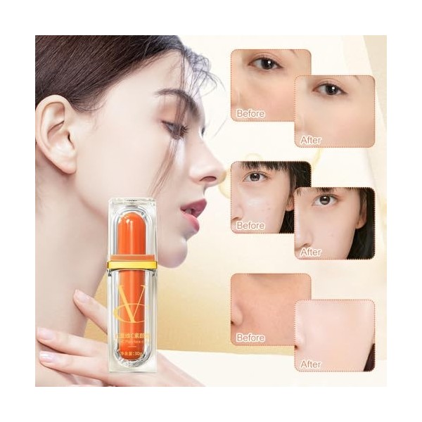 Fengyang® Crème Eclat A La Vitamine C, Crème BB A La Vitamine C, Anti-cernes Hydratant Eclaircissant, Raffermit La Peau, Conv