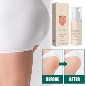 Crème Dissolvant de Boutons pour les Fesses, 100 ML Crème pour les Boutons des Fesses, 2025 Nouveau