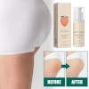Crème Dissolvant de Boutons pour les Fesses, 100 ML Crème pour les Boutons des Fesses, 2025 Nouveau
