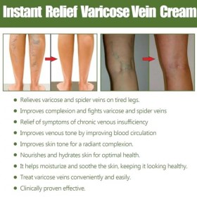2 Pièces Crème contre les Varicosités, Varicose Vein Repair Cream, Améliore Circulation Soin Jambes Lourdes Relief Veins, Tra