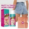 Crème pour les Boutons des Fesses,Lotion de Compensation de lacné des Fesses,Anti-Boutons pour les Fesse,Nettoyante Contre l