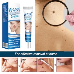 Crème Anti-Verrues, Pour Les Types De Peau, 1pc