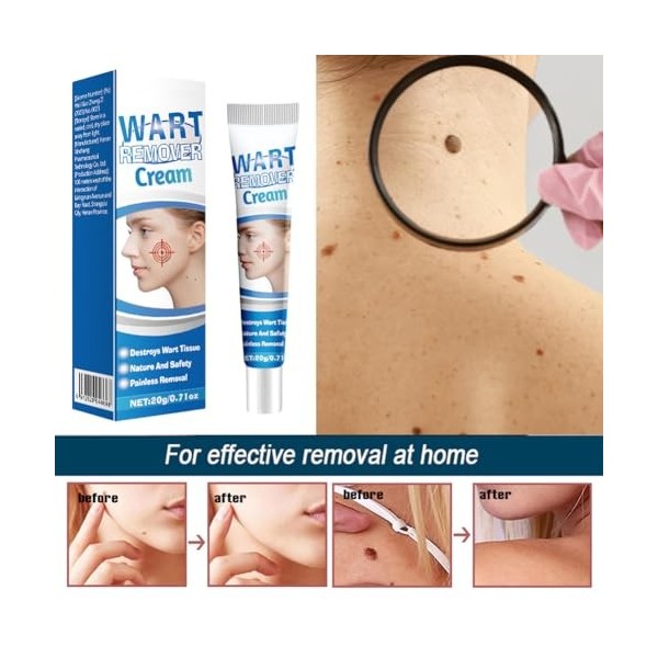 Crème Anti-Verrues, Pour Les Types De Peau, 1pc