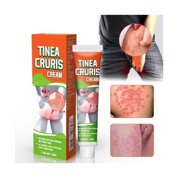 2 Pièces Crème Apaisante à Base de Plantes, Pommade Contre leczéma, Skin Therapy Cream, Soulage Efficacement les Démangeaiso