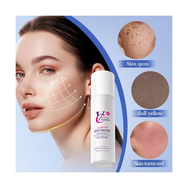 Whitening And Freckle Removing Essence, 100 ml, sérum pur à la niacinamide, détachant pour le visage, sérum correcteur de poi