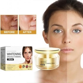 Crème pour le visage pour enlever les taches de rousseur, crème éclaircissante pour le visage et le corps, crème blanchissant