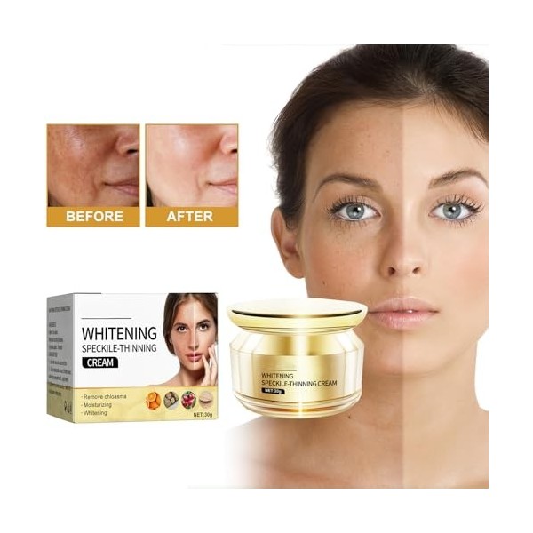 Crème pour le visage pour enlever les taches de rousseur, crème éclaircissante pour le visage et le corps, crème blanchissant