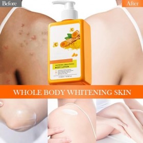 Hppsctink Lait corporel au curcuma, 300ml Lotion corporelle blanchissante au curcuma, Peau lisse, Améliore la sécheresse et l