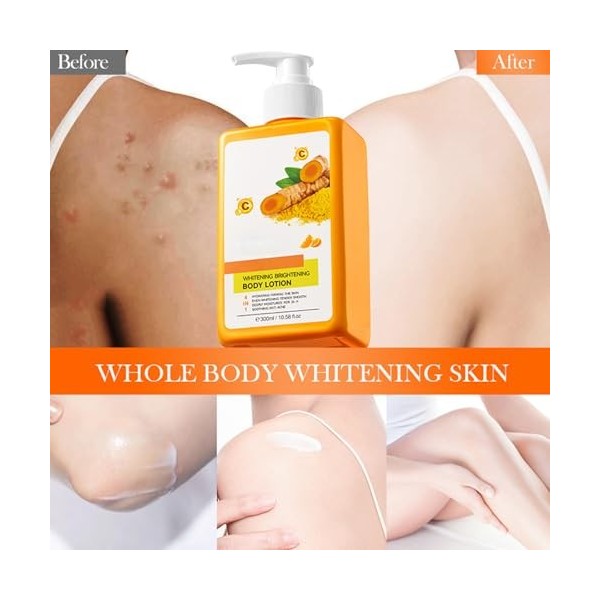 Hppsctink Lait corporel au curcuma, 300ml Lotion corporelle blanchissante au curcuma, Peau lisse, Améliore la sécheresse et l