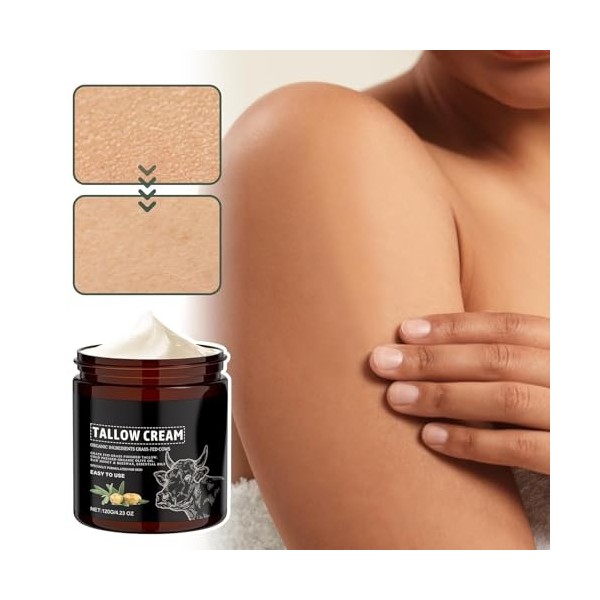 Crème pour le visage - 120 g - Baume corporel hydratant naturel - Soin apaisant non gras pour le visage - Pour peaux sèches e