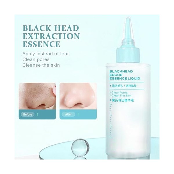 Gwtdtoad Lotion Nettoyante Pour La Peau Du Nez - Solution Nettoyante Peau Nez Élimination Impuretés | 150ml Solution Visage A