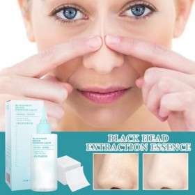 Runkoyea Liquide Nettoyant pour la Peau du Nez - Nettoyant Cutané Éliminateur des Impuretés des Ailes du Nez | Solution Rapid