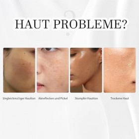 Sérum alpha arbutine 2% contre les taches brunes, lacné, les pores, la décoloration de la peau, sérum alpha arbutine 2% avec