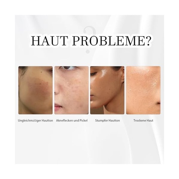 Sérum alpha arbutine 2% contre les taches brunes, lacné, les pores, la décoloration de la peau, sérum alpha arbutine 2% avec