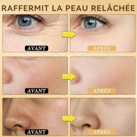 Stick de sérum raffermissant au venin dabeille, 2 Pièces Creme Venin DAbeille, Multi-Usage Crème Anti Ride pour l’Éliminati