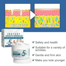 5 Secondes Délimination De Rides,Crème Anti-rides Instantanée 5 Secondes,Raffermissant De La Peau,Pour Tous Types,30ML