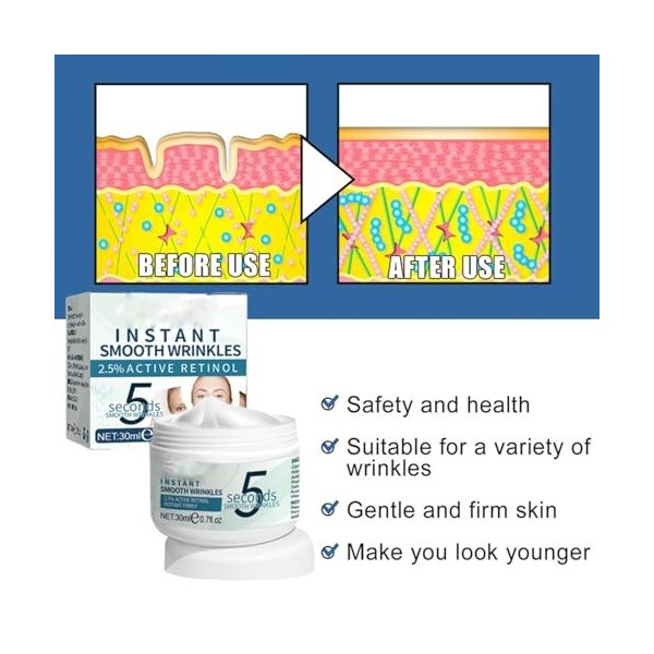 5 Secondes Délimination De Rides,Crème Anti-rides Instantanée 5 Secondes,Raffermissant De La Peau,Pour Tous Types,30ML