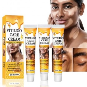 Grgowe Crème Traitement Vitiligo - 3pcs Pommade Taches Blanches