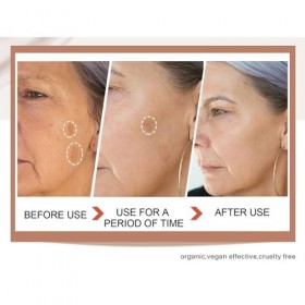 Glutathione Skin W-hi Tening Cream,Crème de Blanchiment du Visage Glutathione,Moisturizing Skin Brightener Cream