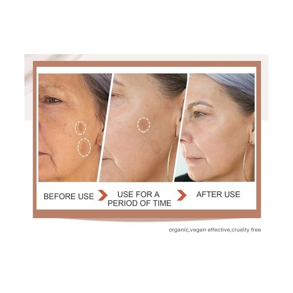 Glutathione Skin W-hi Tening Cream,Crème de Blanchiment du Visage Glutathione,Moisturizing Skin Brightener Cream