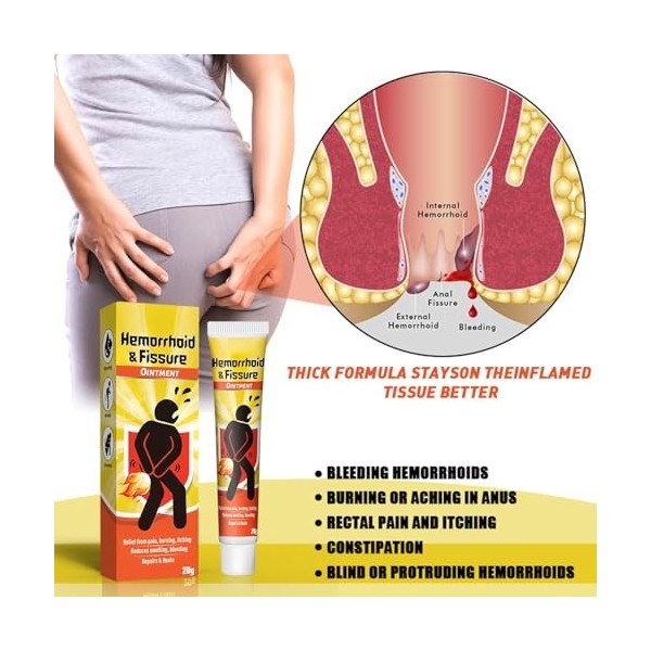 2PC Hémorroïdes Cream,Lotion De Traitement Contre Les Hémorroïdes, Skin Therapy Cream, Réduit les Gonflements, Soulage la Dou