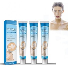 3pcs Vitiligo Cream,Crème De Vitiligo,Crème De Traitement Du Vitiligo,Vitiligo Pommade,Crème De Soin Vitiligo Pour La Peau Vi