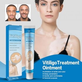 3pcs Vitiligo Cream,Crème De Vitiligo,Crème De Traitement Du Vitiligo,Vitiligo Pommade,Crème De Soin Vitiligo Pour La Peau Vi