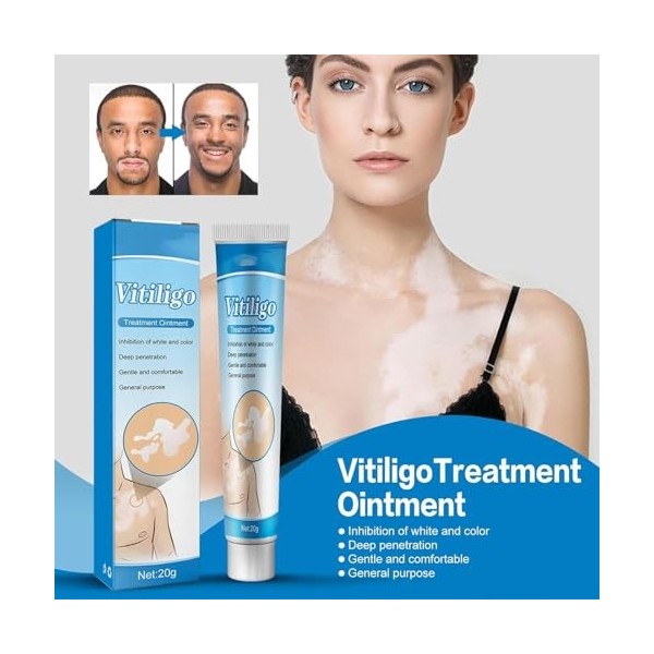 3pcs Vitiligo Cream,Crème De Vitiligo,Crème De Traitement Du Vitiligo,Vitiligo Pommade,Crème De Soin Vitiligo Pour La Peau Vi