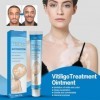 3pcs Vitiligo Cream,Crème De Vitiligo,Crème De Traitement Du Vitiligo,Vitiligo Pommade,Crème De Soin Vitiligo Pour La Peau Vi