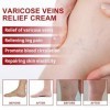 2PC Cream contre les Varicosités, Varicose Vein Repair Crème, pour un Traitement Efficace des Varices Traitement Jambes Crème