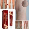 2PC Crème Contre Les Varicosités,Varicose Vein Repair Lotion,Réparation Des Jambes DAraignée,Skin Therapy Cream,Traitement D
