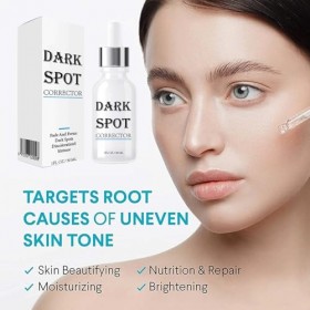 Avocado 2PC Dark Crème Blanchissante,Creme Visage Anti Taches,Anti taches Creme Crème anti-taches de rousseur,Traitement de l