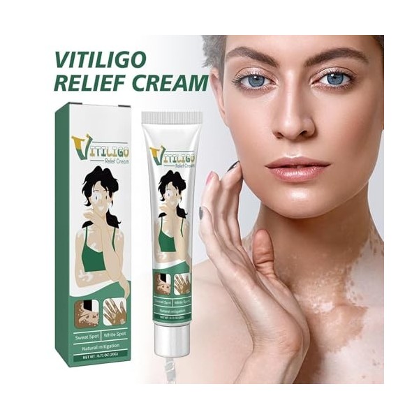Grgowe Crème de vitiligo pour taches blanches, crème de pigmentation pour vitiligo et troubles de la pigmentation de la peau