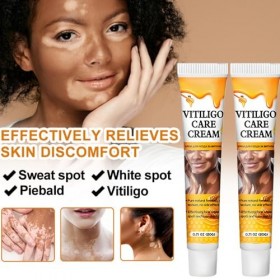 2PC Vitiligo Cream,Vitiligo Pommade,Skin Therapy Cream,Traitement Des Taches Blanches Sur La Peau Réduit La Leucoplasie, Trai