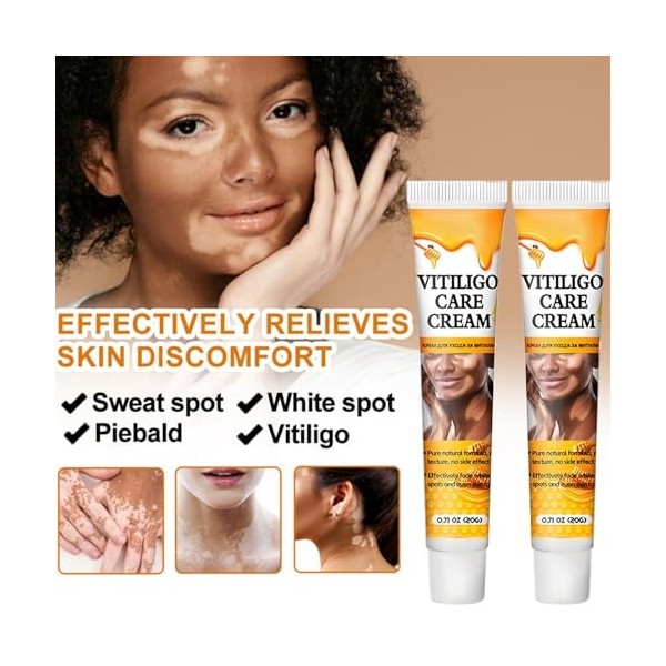 2PC Vitiligo Cream,Vitiligo Pommade,Skin Therapy Cream,Traitement Des Taches Blanches Sur La Peau Réduit La Leucoplasie, Trai