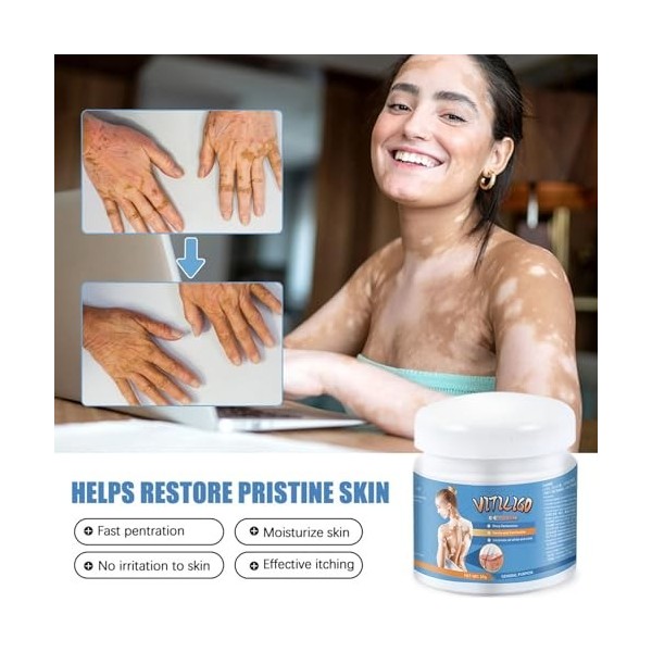 2PC Crème Hydratante Apaisante, Body Care Blam, Skin Therapy Cream, Hydratant et Nourrissant, Aide à Améliorer la Pigmentatio