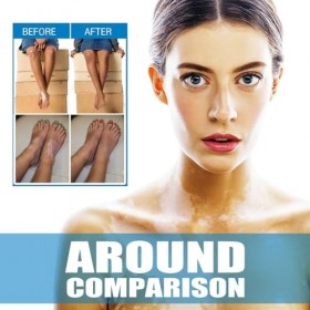 2PC Skin Therapy Cream, Crème Hydratante Apaisante, Body Care Blam, Aide à Améliorer la Pigmentation et le Teint Irrégulier d