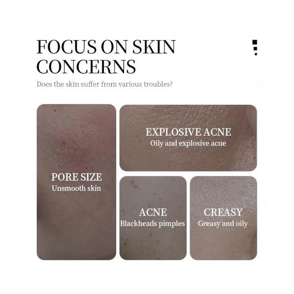 Sérum éclaircissant et hydratant pour le visage, sérum anti-taches et anti-acné, nourrissant doux, peau éclatante et hydratat