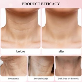 Sérum hydratant pour le cou et le visage,Sérum visage lisse la peau,Essence de soin rapide,Hydrate, laisse la peau Plus propr